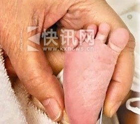 吴佩慈未婚先孕产下爱女 女儿脚丫照曝光