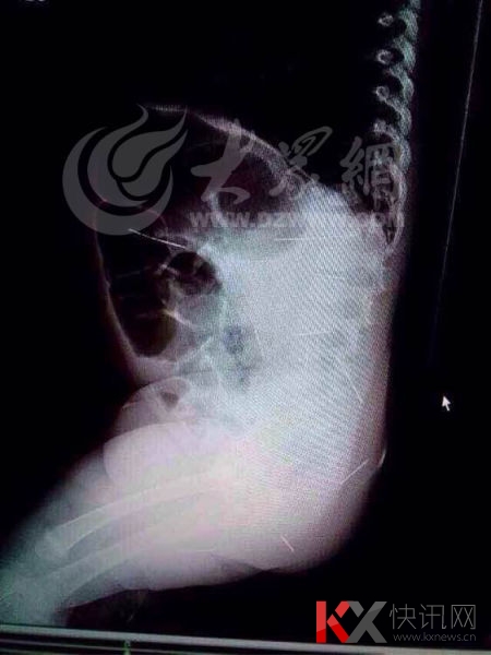 ŮӤС�������ڵĸ���